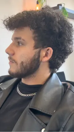 Antes X depois 