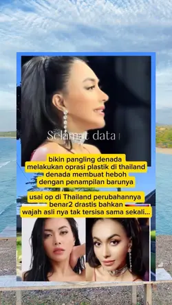 Denada usai operasi 