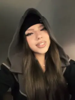kiss it better