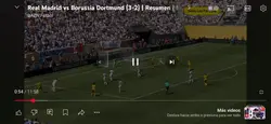 RMA vs DORT