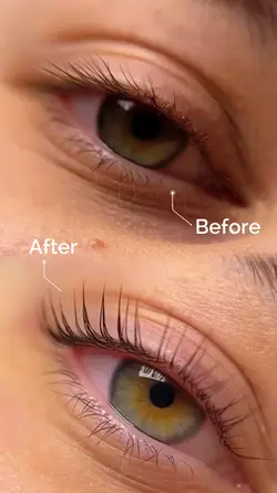 Before and after