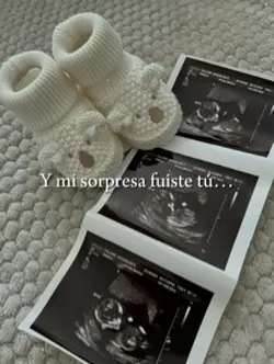 Mi sorpresa fuiste t
