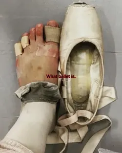 Beauty is pain.