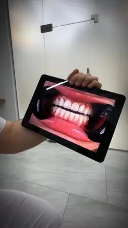 Dentista FACETAS