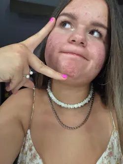 4TH OF JULY