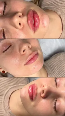 Before after