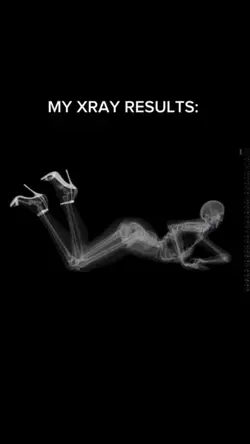 x-ray result