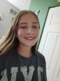 braces colors