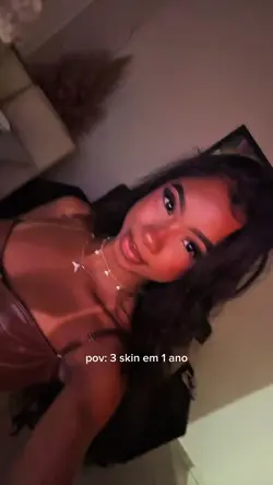 3 SKIN EM 1 ANO
