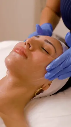 Microneedling