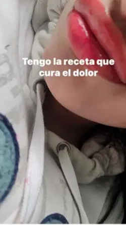 IG