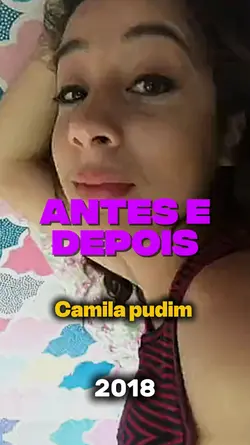 Antes e depois 