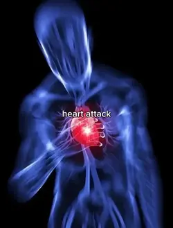 heart attack