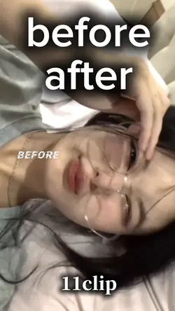 before✨after 11clip