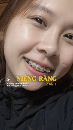 NIỀNG RĂNG