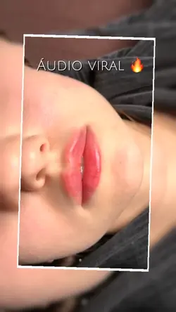 Micro labial