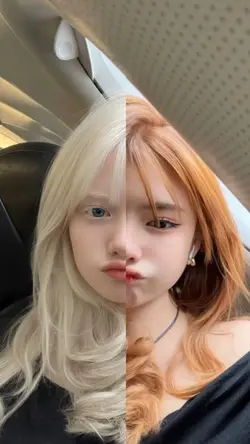 TREND ALBINO NIH