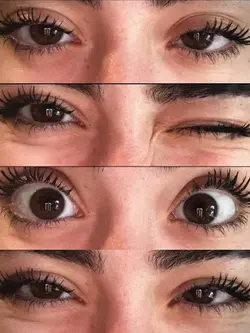 Eye trend filter