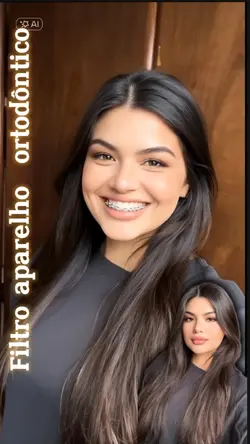 Aparelho nos  dentes