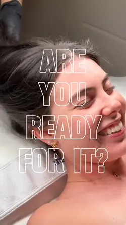 microneedling