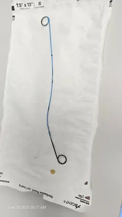 Stent removal day