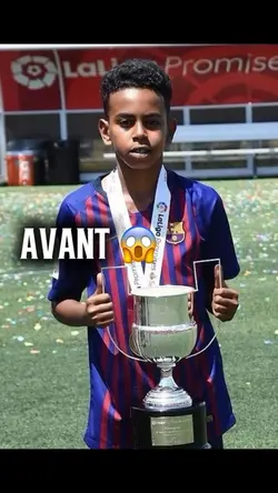 Avant après IA 🔥😱