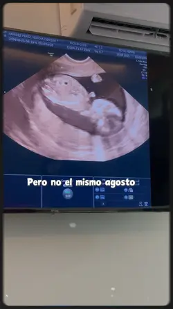 Agosto de nuevo 