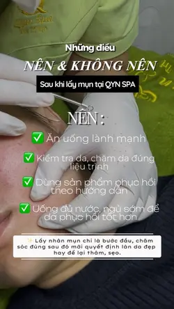 Mẫu spa