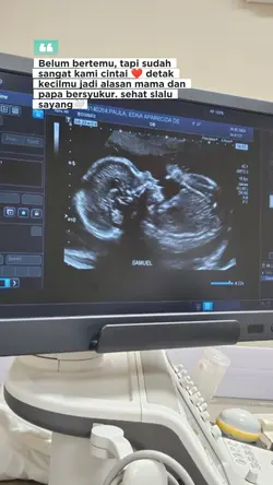 Story Foto USG bayi