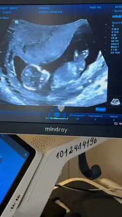 Pregnancy journey