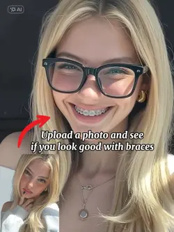 Filter with braces 