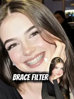 Brace filter