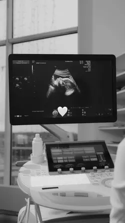 Ultrasound baby