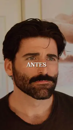 ANTES E DEPOIS 2.0