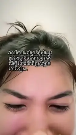 ឈឺ..... It's hurt 