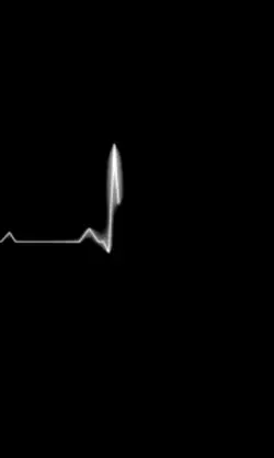 Heartbeat countdown