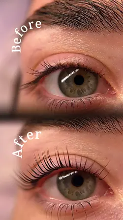 Before and after