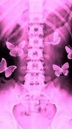 Effets papillons