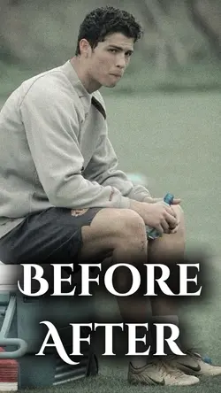 Before after