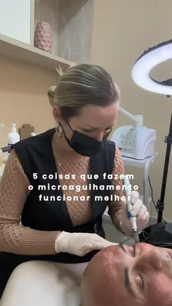 Microagulhamento