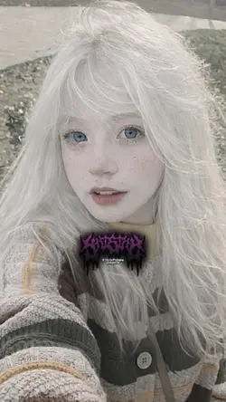 trend albino