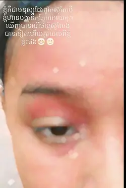 ខ្ញុំនៅក្មេងណាស់មិន