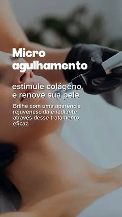 Microagulhamento