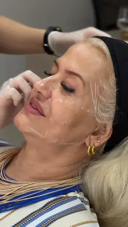 Estética