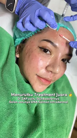 Treatment di ZAP 