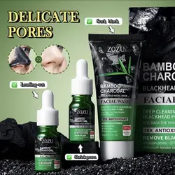 Blackhead Removal