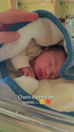 Antes e depois