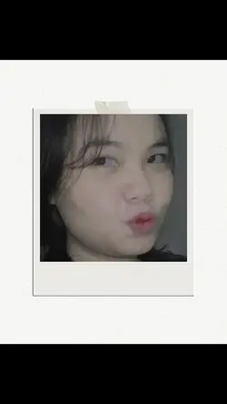 aesthetic frame