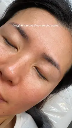 Before after brows
