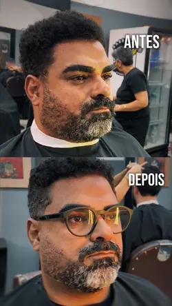 Antes e Depois 